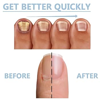 2REVINAIL® REPARA, FORTALECE Y LUCE TUS UÑAS